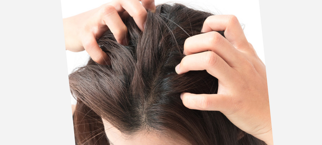 Do you suffer from itching and an irritated scalp?